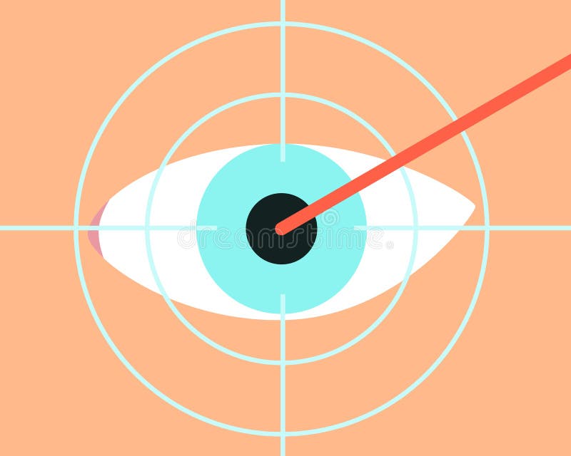 Laser vision correction royalty free illustration