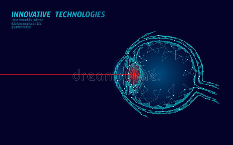 laser vision correction medicine operation concept innovation technology health care eye d low poly polygonal laser vision 135040677