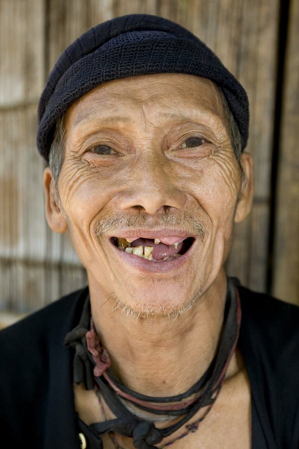 Laughing old man with bad teeth, Laos. 