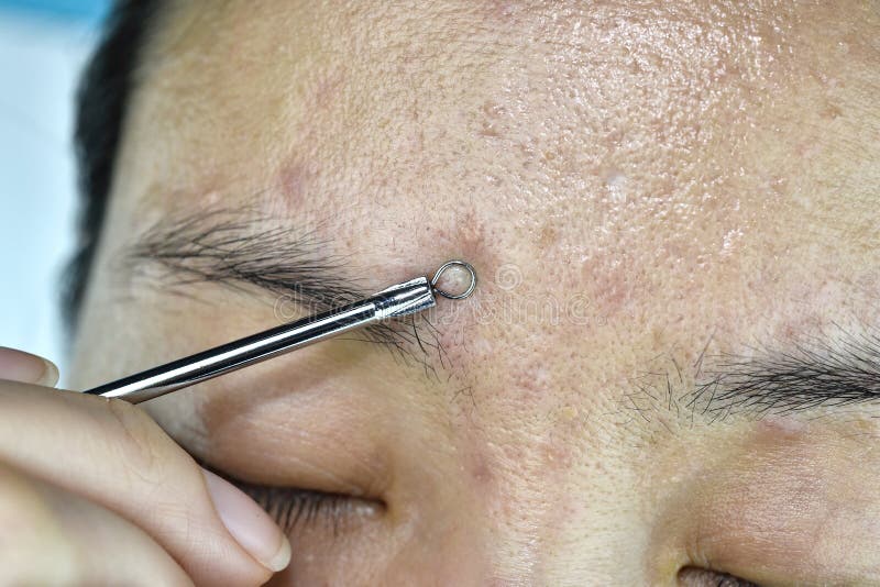 Le Problème De Peau Avec Les Maladies D