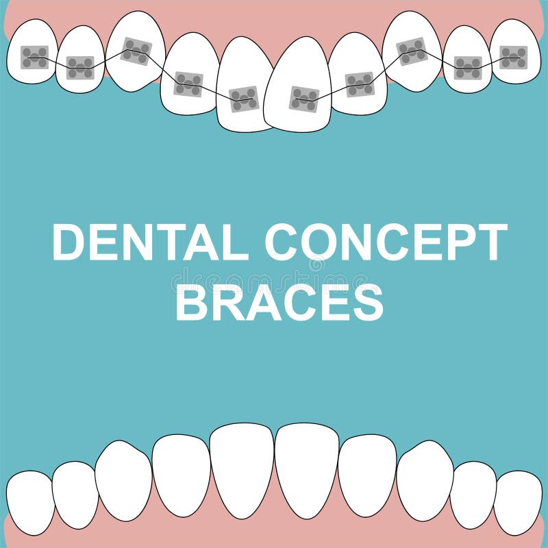 Le stimulant de banni?re attache le vecteur d'illustration de dents sur le fond bleu Concept dentaire illustration de vecteur Le stimulant de banni?re attache le vecteur d'illustration de dents sur le fond bleu Concept dentaire illustration de vecteur