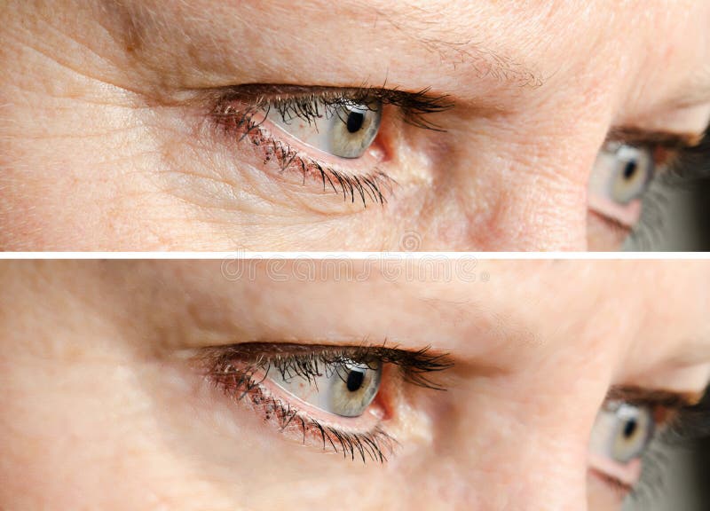 Le visage ride le retrait image stock Le visage ride le retrait image stock