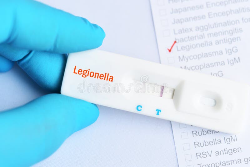Legionella positive test royalty free stock photos