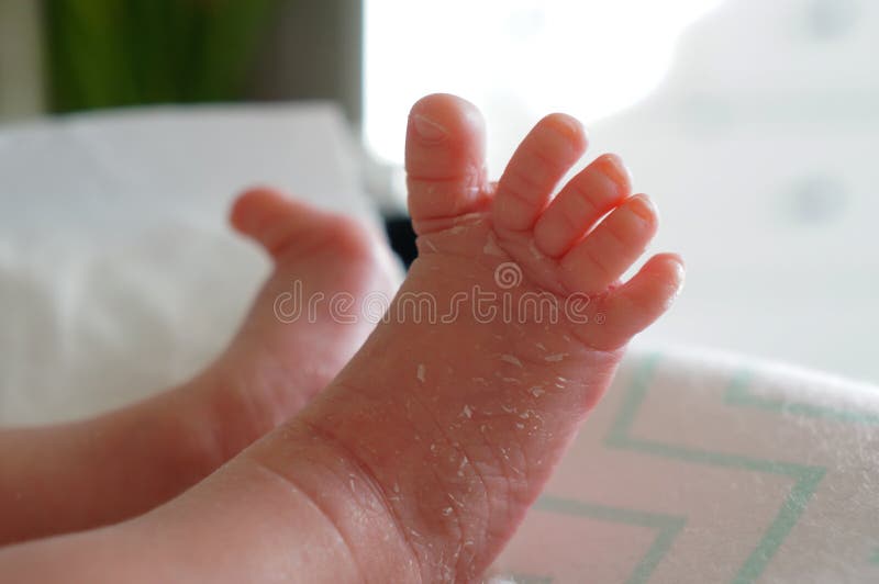 136 Newborn Skin Peeling Stock Photos Free & RoyaltyFree Stock