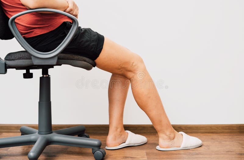 Legs Pain Concept Legs Tied with Rope Isolated on White Stock Photo