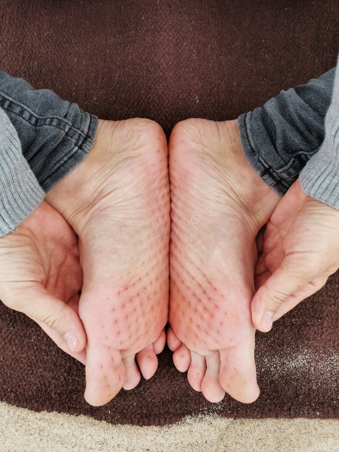 Legs of a Yoga Girl after Standing on Sharp Needles for a Long Time in  Nature. Practice Standing on the Board of a Sadhu Stock Photo - Image of  selfknowledge, naked: 200372246