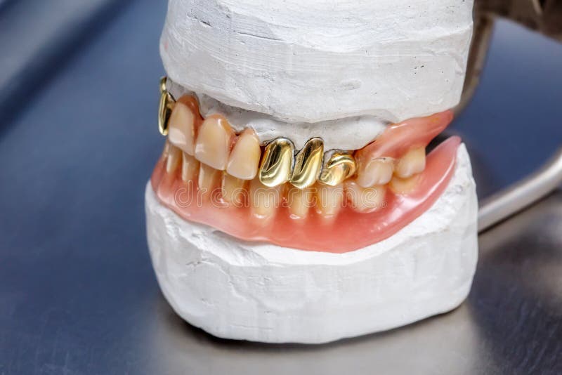Les dents prothèse, gommes humaines d'or dentaire de moule d'argile modèlent images stock Les dents prothèse, gommes humaines d'or dentaire de moule d'argile modèlent images stock