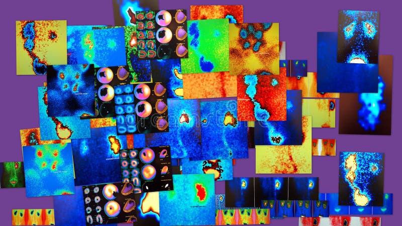 Nuclear medicine images in the form of collage demonstrate some type of examinations :myocardial perfusion,thyroid,renal scan ,parathyroid. Nuclear medicine images in the form of collage demonstrate some type of examinations :myocardial perfusion,thyroid,renal scan ,parathyroid