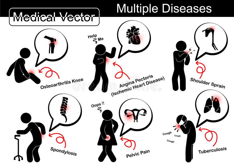 Les maladies multiples illustration de vecteur Les maladies multiples illustration de vecteur