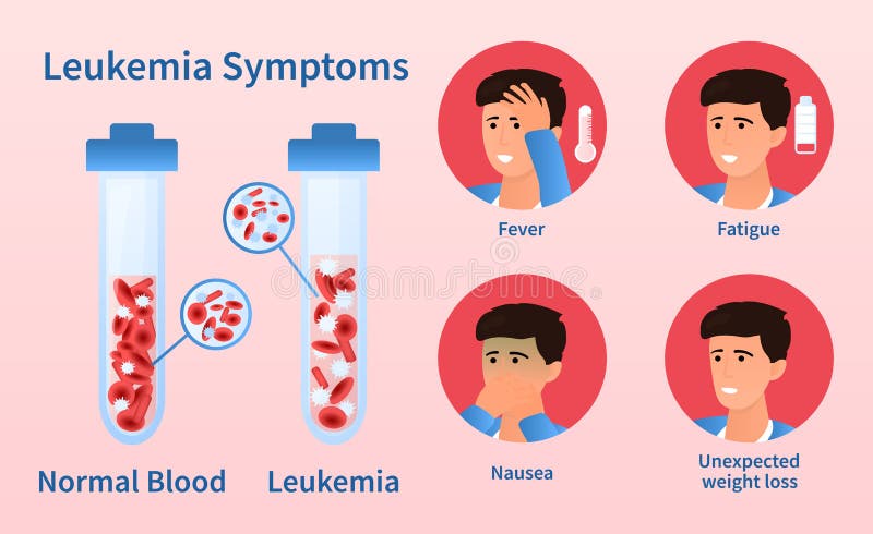Leukemia Dangerous Disease Concept Stock Vector Illustration Of Lymph