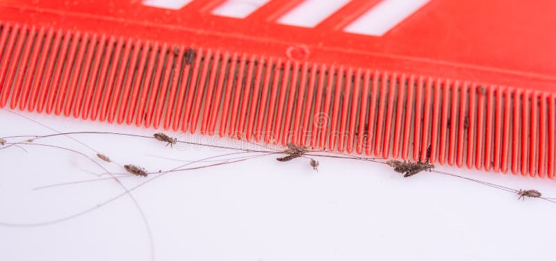 Lice in hair and comb stock photo. Image of care, hair - 152910740