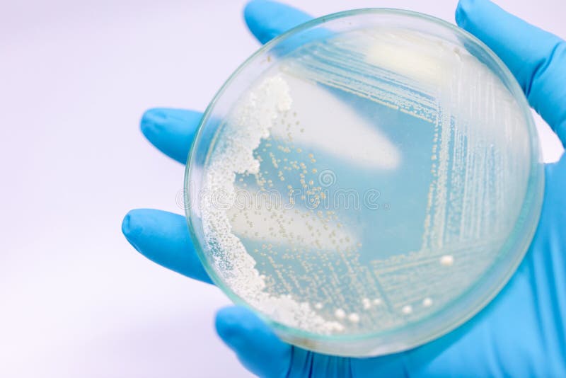 Lievito nella capsula di Petri, microbiologia per istruzione