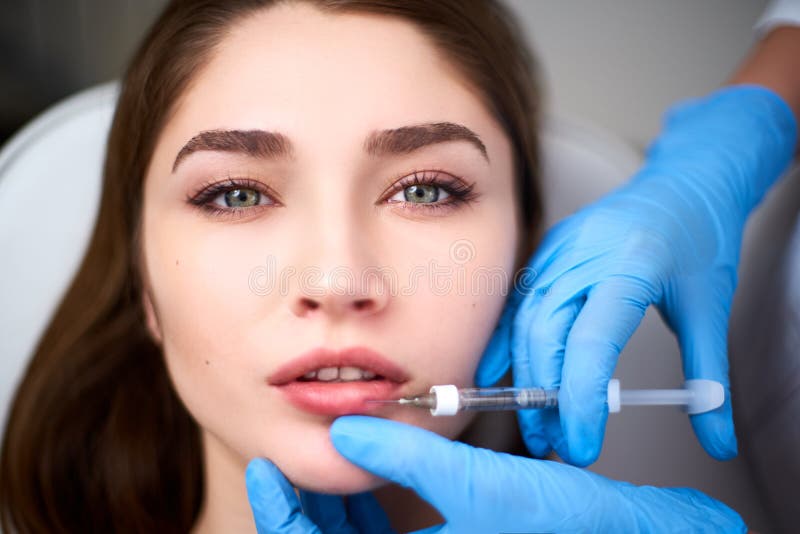 Lip Augmentation. Closeup Of Beautician Doctor Hands Doing Beauty Procedure To Female Lips with Syringe. Young Woman`s royalty free stock photography Lip Augmentation. Closeup Of Beautician Doctor Hands Doing Beauty Procedure To Female Lips with Syringe. Young Woman`s royalty free stock photography