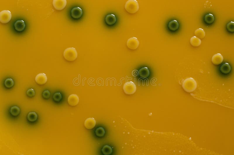 Listeria Monocytogenes Stock Photos Free & RoyaltyFree Stock Photos
