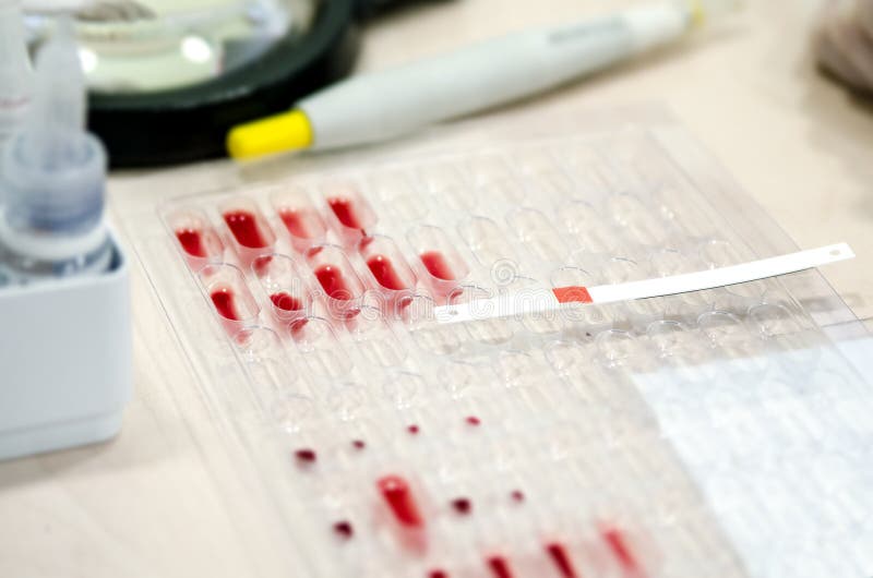 Litmus Strip on Pallets with the Blood To Determine the Rh Factor. Stock Photo Image of exam