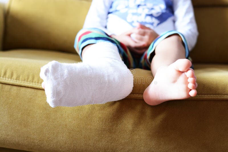 Little Child with Plaster Bandage on Leg Heel Fractured Stock Photo