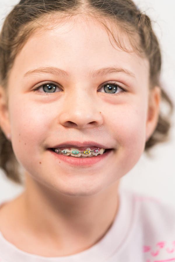 Little Girl with Rainbow Braces Stock Photo Image of cute, smile