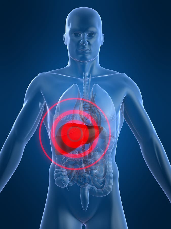 Liver inflammation stock illustration. Image of bones 3371178