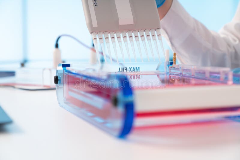 Loading Samples and Running an Agarose Gel for Electrophoresis, Gel