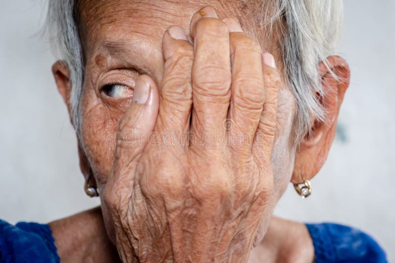 Lonelydementia старухи валя и Alzheimer, заболевание стоковое изображение