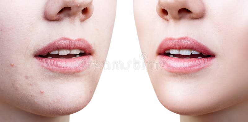 Los labios perfectos del ` s de la mujer antes y despu?s de retocan fotos de archivo libres de regalías Los labios perfectos del ` s de la mujer antes y despu?s de retocan fotos de archivo libres de regalías