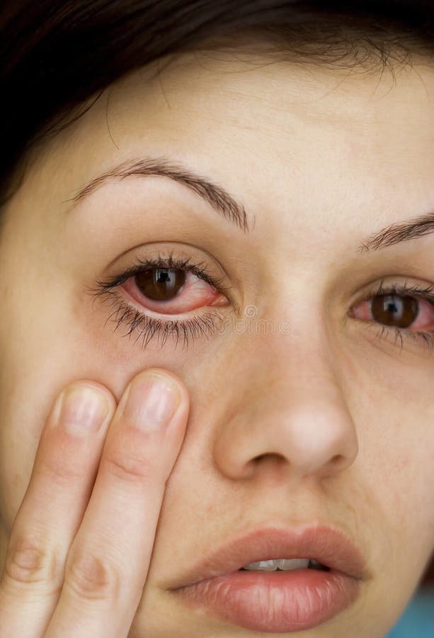 Los Ojos De La Mujer Enferma Imagen de archivo de enfermo Los Ojos De La Mujer Enferma Imagen de archivo