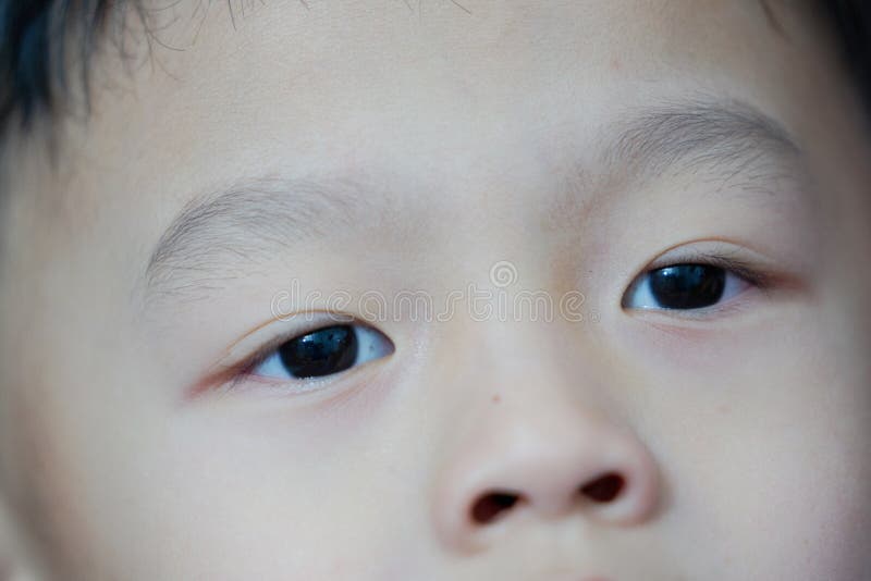 Los ojos y la nariz del muchacho de los jóvenes, cerrados encima de la visión imagen de archivo Los ojos y la nariz del muchacho de los jóvenes, cerrados encima de la visión imagen de archivo