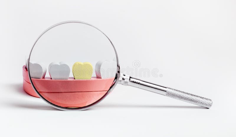 Dentiste Avec Loupe Sur Mâchoire Modèle Avec Dents. Examen Dentaire  Régulier Examen De La Bouche Des Gencives Image stock - Image du sain,  contrôle: 248317051