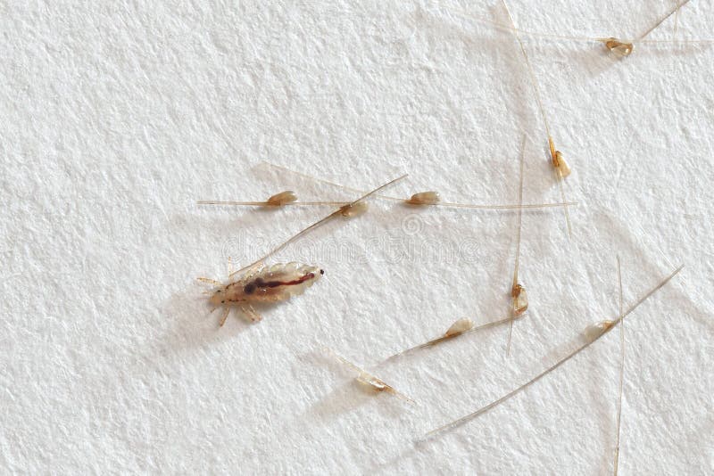 Nits on the Hair, on White Paper Background Stock Photo Image of head