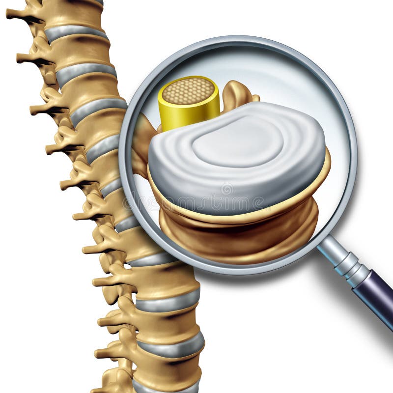 Lumbar spine anatomy segment medical concept as a close up of the human back skeleton as a vertebral magnification with a spinal cord and disk as a 3D illustration isolated on white.