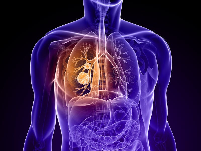 Gesunde Lunge Und Raucher-Lunge Stock Abbildung..