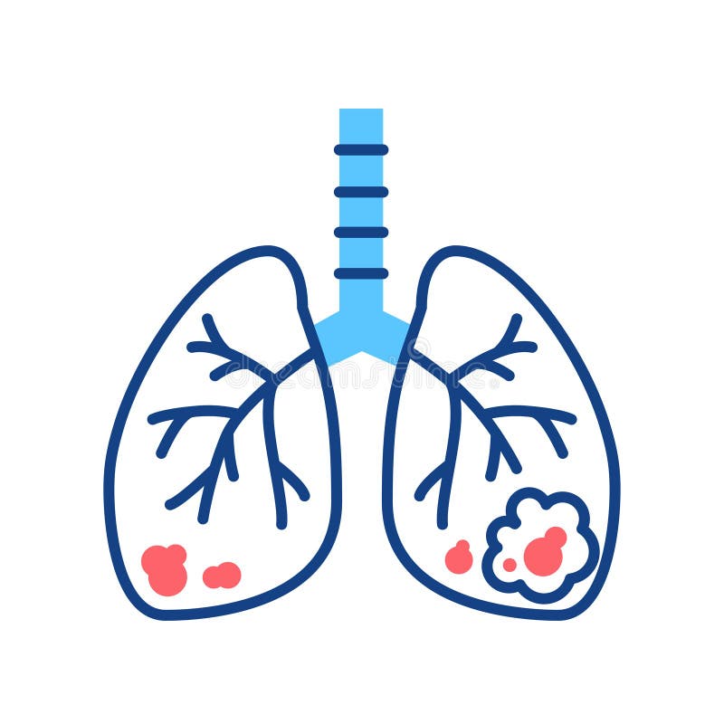 Lungs cancer line color icon. Human organ concept. Malignant neoplasm. Sign for web page, mobile app, button, logo. Vector isolated element. Editable stroke