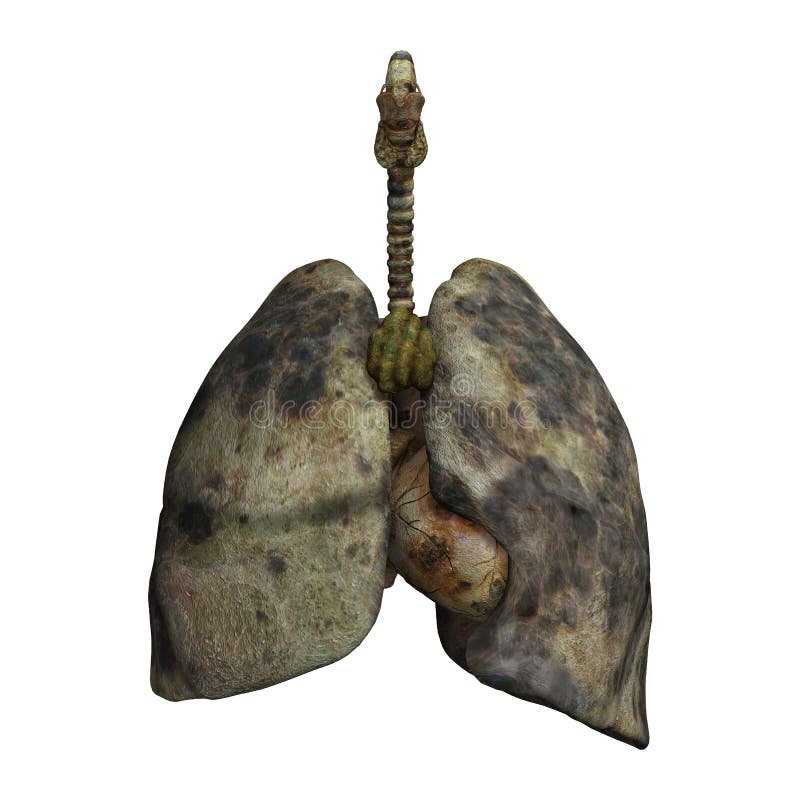 Lungs Of Smokers Royalty Free Stock Photos Image 34677988