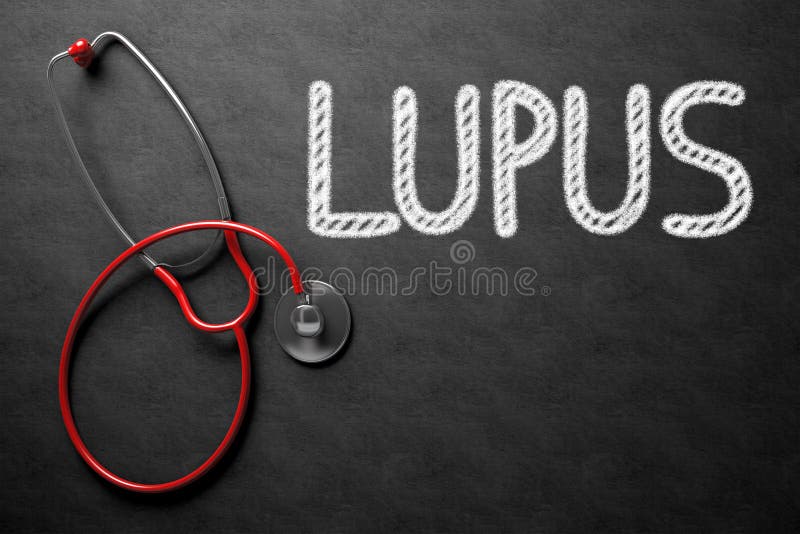 Black Chalkboard with Lupus - Medical Concept. Medical Concept: Black Chalkboard with Lupus. 3D Rendering. Black Chalkboard with Lupus - Medical Concept. Medical Concept: Black Chalkboard with Lupus. 3D Rendering.