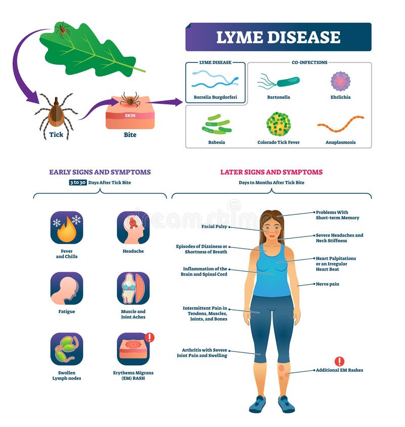 Lyme-Borreliose-Vektorillustration Beschriftete Zeckenbissinfektions-Symptomliste vektor abbildung Lyme-Borreliose-Vektorillustration Beschriftete Zeckenbissinfektions-Symptomliste vektor abbildung