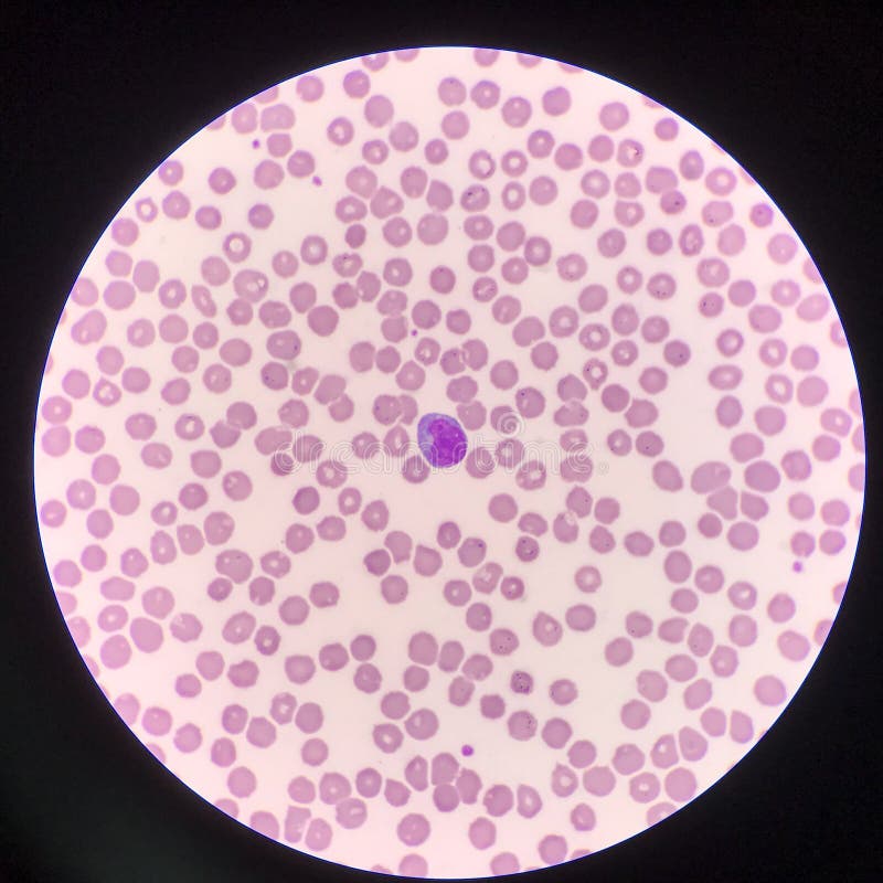 Lymphocyte atypique sur le fond de globules rouges image libre de droits Lymphocyte atypique sur le fond de globules rouges image libre de droits