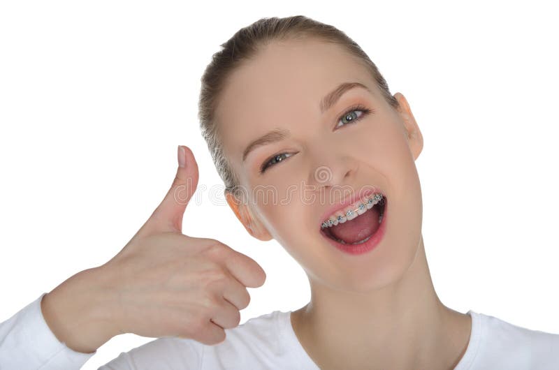 Lächelndes Mädchen mit Klammern stockfoto Lächelndes Mädchen mit Klammern stockfoto