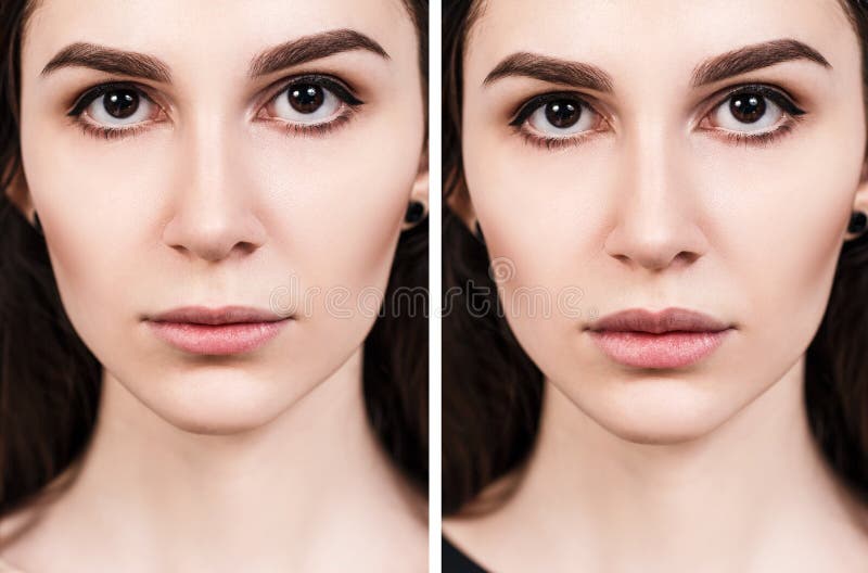Lèvres de jeune femme avant et après l'augmentation images libres de droits Lèvres de jeune femme avant et après l'augmentation images libres de droits