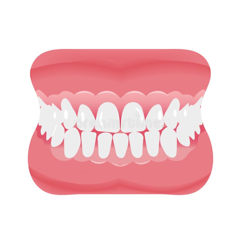 Fausses Dents Humaines - Prothèse Acrylique Permanente. Croquis Du Faux  Dentier. Clip Art Libres De Droits, Svg, Vecteurs Et Illustration. Image  168891198