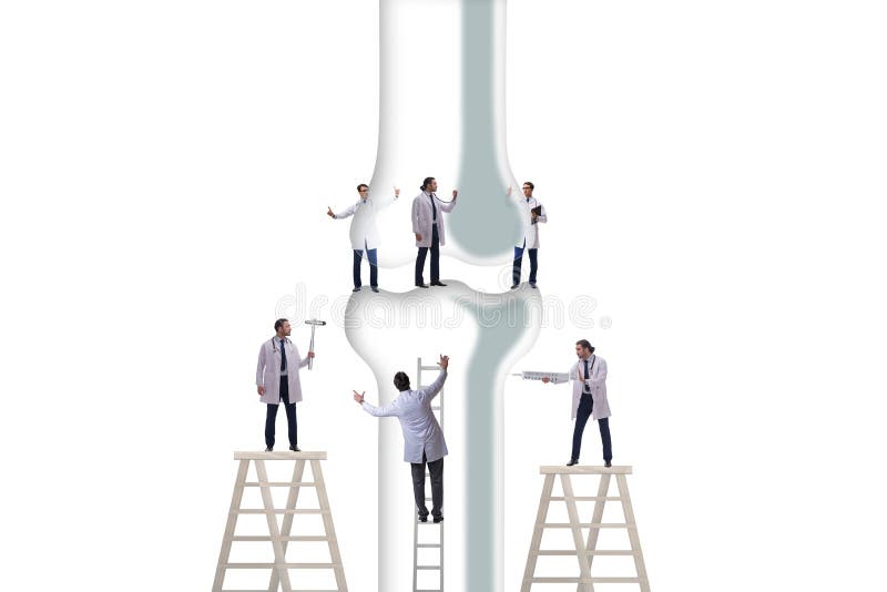 Joint D Os Image Stock Image Du Centre Cartilage Ossification