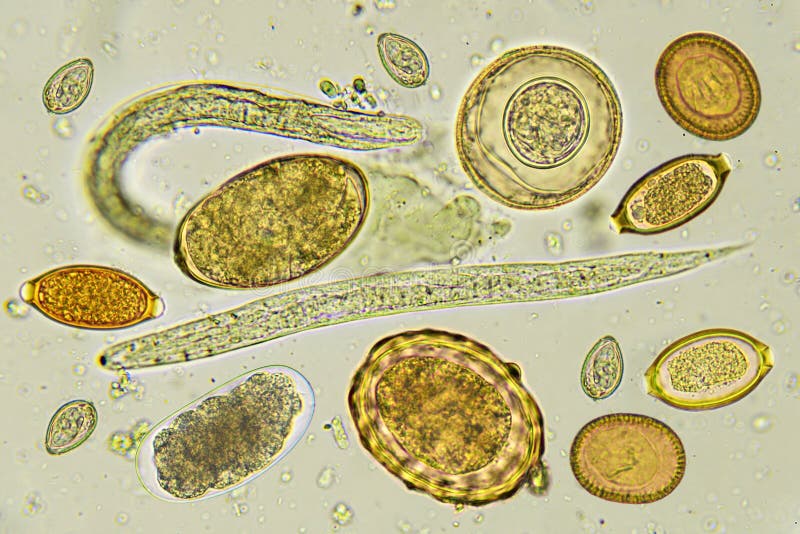 Amibes paraziták - Les parasites des selles