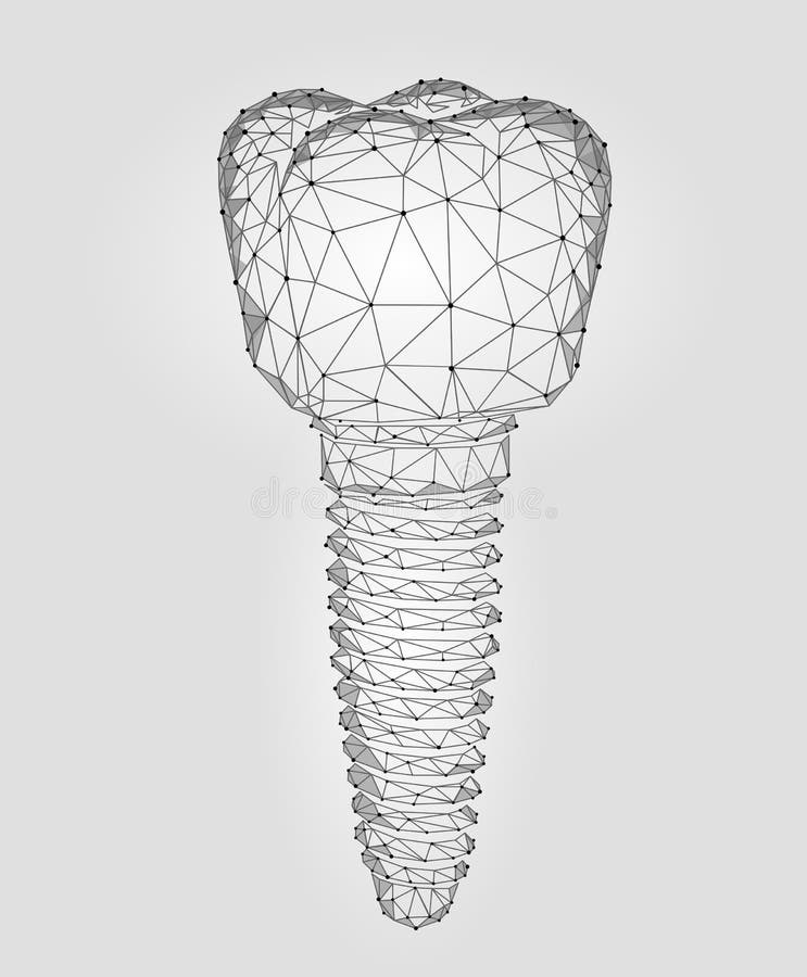 Maaltand tandimplant 3d laag poly geometrisch model Van de de technologietitaan van de tandheelkundeinnovatie toekomstige het met royalty-vrije illustratie Maaltand tandimplant 3d laag poly geometrisch model Van de de technologietitaan van de tandheelkundeinnovatie toekomstige het met royalty-vrije illustratie
