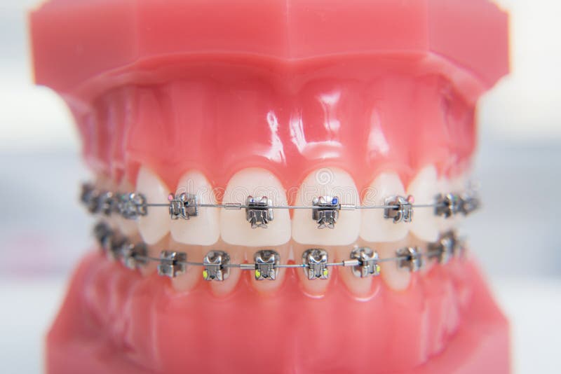 On Macro Photos Shows How the System of Brackets is Arranged Stock