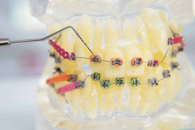 On Macro Photos Shows How the System of Brackets is Arranged Stock