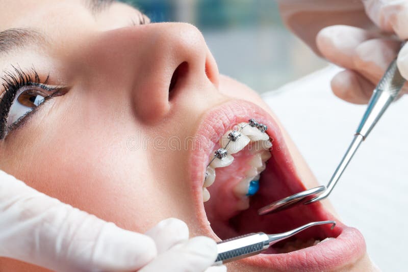 Mains de dentiste travaillant aux bagues dentaires image stock Mains de dentiste travaillant aux bagues dentaires image stock