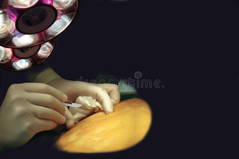 Mains et scalpel. Chirurgie sur l'orientation. Concept image libre de droits Mains et scalpel. Chirurgie sur l'orientation. Concept image libre de droits