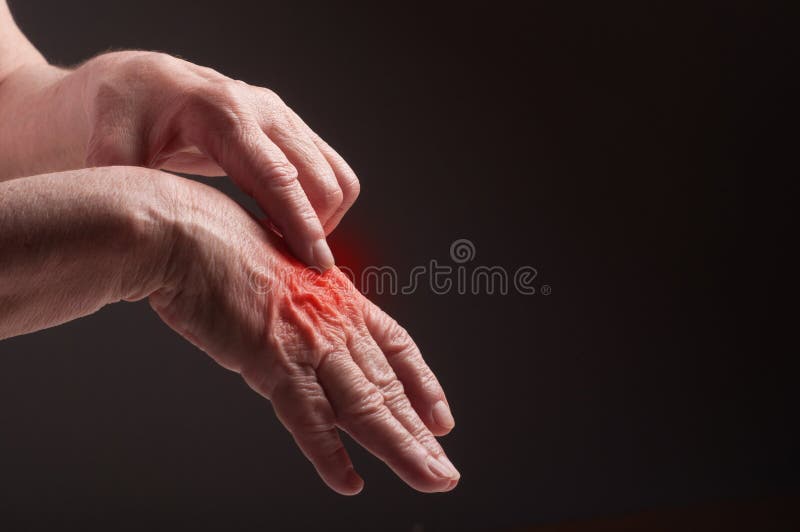 Mains supérieures. Souffrance de la douleur et du rhumatisme photographie stock libre de droits Mains supérieures. Souffrance de la douleur et du rhumatisme photographie stock libre de droits