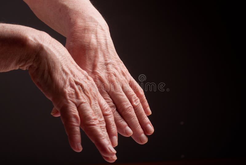 Mains supérieures. Souffrance de la douleur et du rhumatisme image libre de droits Mains supérieures. Souffrance de la douleur et du rhumatisme image libre de droits