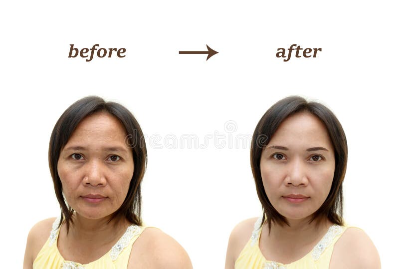 Asian middle-aged woman who has skin problem, concept of before and after makeup or plastic surgery. Problem wrinkle stock images, royalty-free photos and pictures