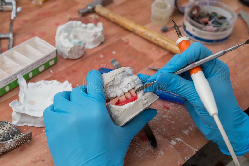 Manufacturing of dentures stock photo. Image of salon 274493824